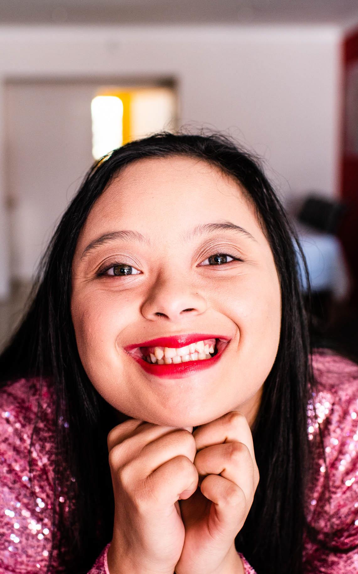 model with Down Syndrome.